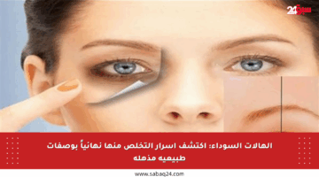 الهالات السوداء: اكتشف أسرار التخلص منها نهائياً بوصفات طبيعية مذهلة